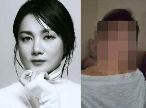 얼굴 공개한 박나래의 '주사이모'…