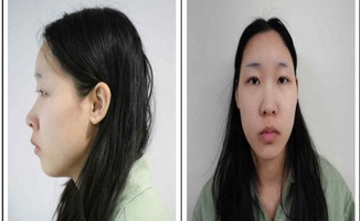 강북 모텔 약물 살인 피의자 신상 공개… 20세 김소영