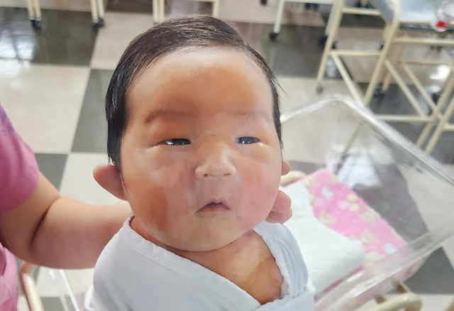 이용비 산모 아기.