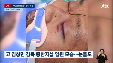  故 김창민 감독 '응급실 사진' 보니…피멍든 눈가에 눈물 '공분'
