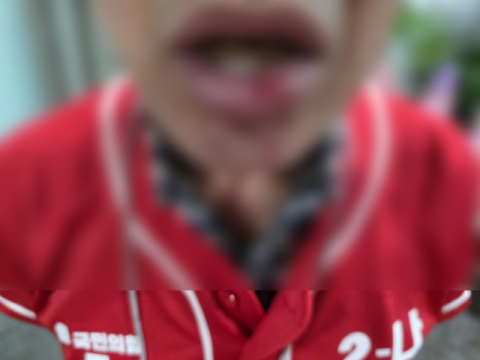 대구 수성구서 국민의힘 구의원 선거운동원 피습…선거 첫날 백주대낮 폭행 파문