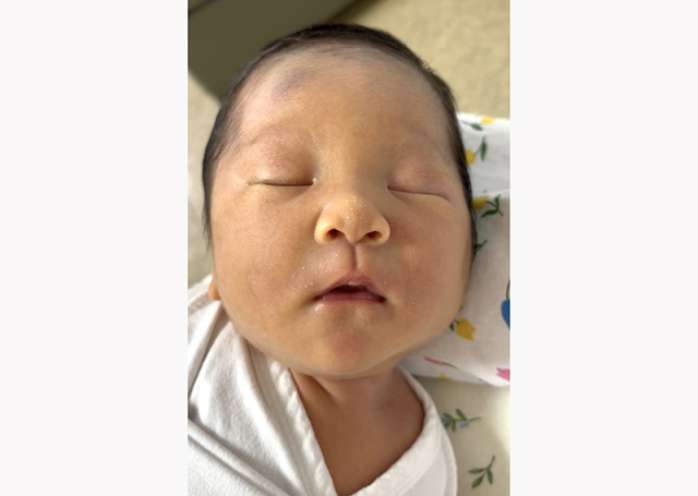 곽수현 산모 아기