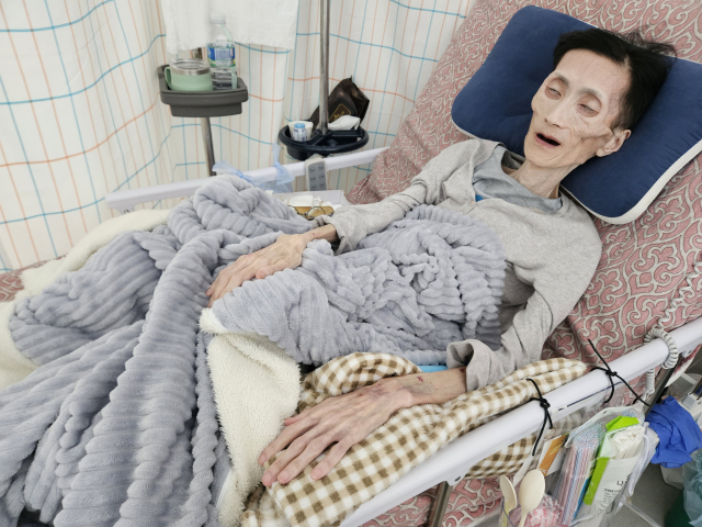 지난달 31일 대구의 한 병원에서 김수형(가명·52) 씨가 병상에 누워 있는 모습. 윤정훈 기자