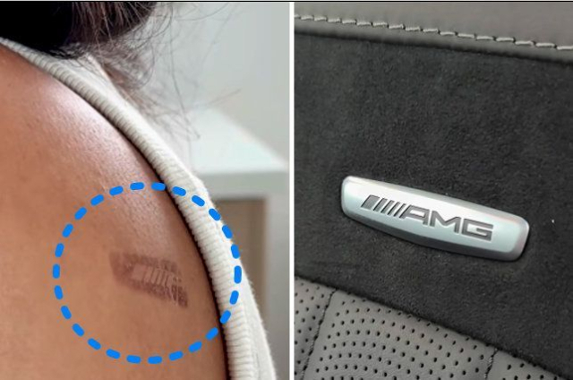 원고 중 한 명인 카렌딥 카리나배스가 게재한 화상 자국. 인스타그램 캡처