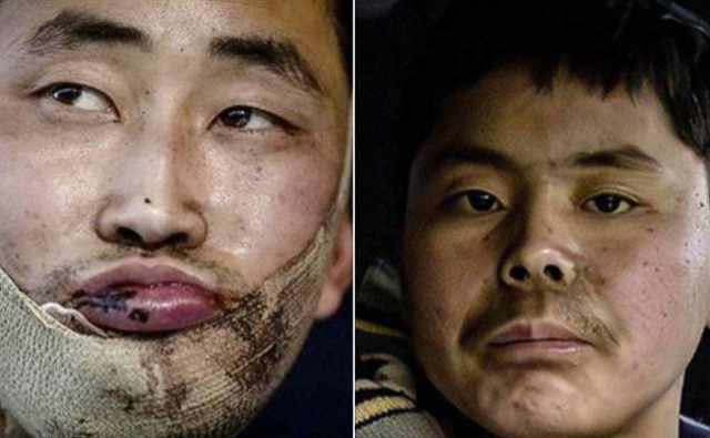 우크라이나군이 러시아 쿠르스크에서 생포한 북한군. 볼로디미르 젤렌스키 우크라이나 대통령 텔레그램 캡처